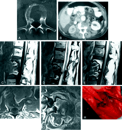 fig 1.