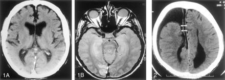 Fig 2.