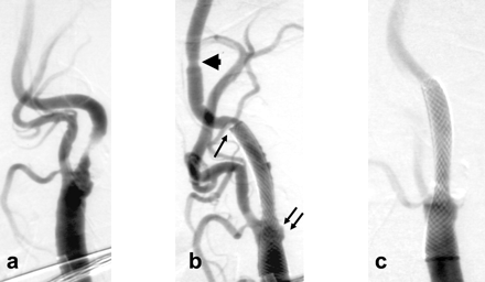 Fig 2.