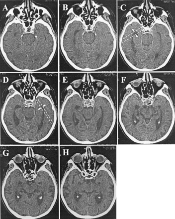 Fig 2.