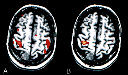 Fig 4.