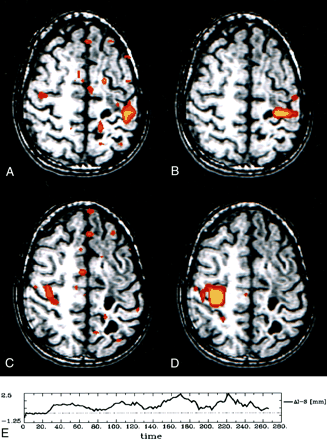 Fig 5.