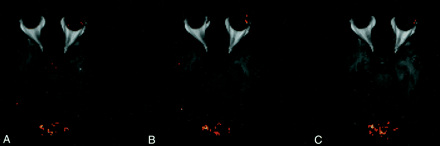 Fig 3.