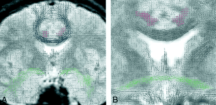 Fig 3.