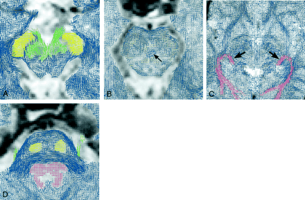 Fig 4.