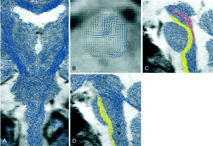 Fig 5.