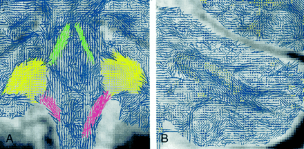 Fig 6.