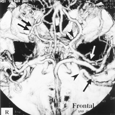 Fig 1.