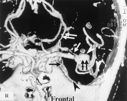 Fig 3.