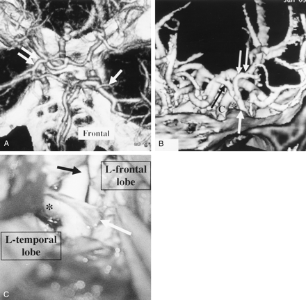 Fig 4.