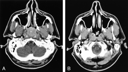 Fig 1.