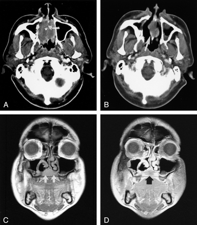 Fig 3.