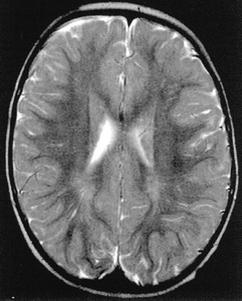 Fig 7.