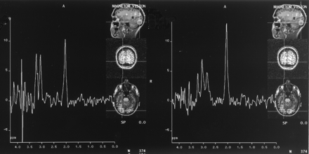 Fig 5.