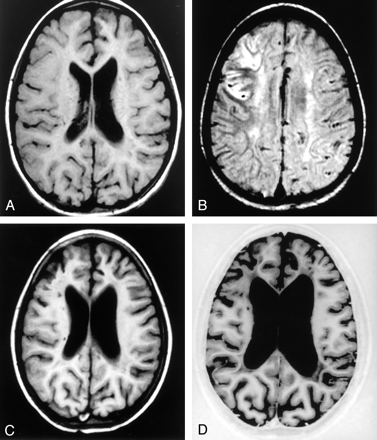 Fig 1.