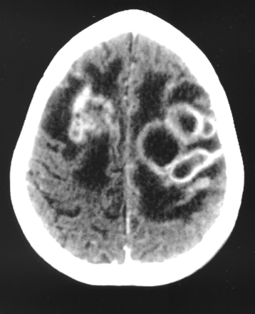 Fig 1.