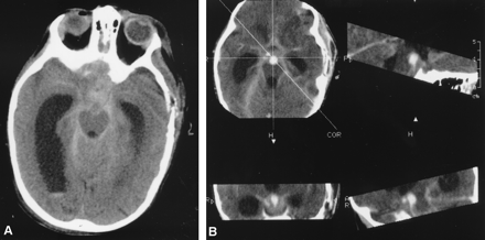 Fig 2.