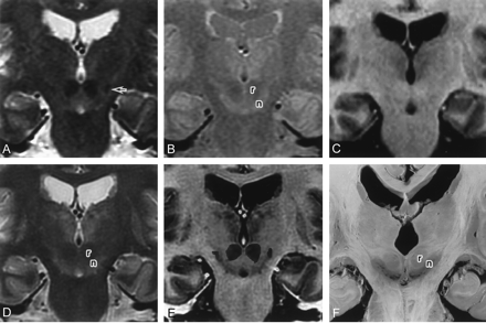 Fig 4.