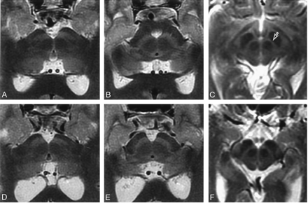 Fig 8.