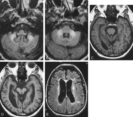 Fig 3.