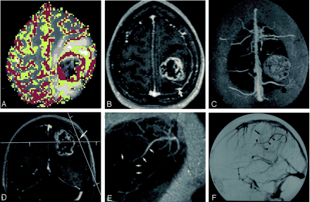 Fig 2.