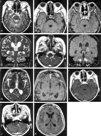 Fig 1.