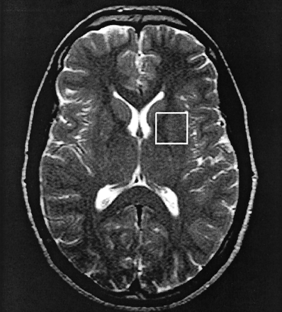 Fig 2.