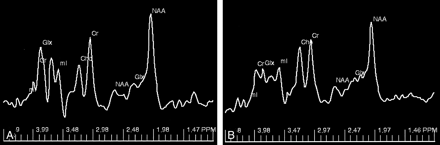Fig 4.