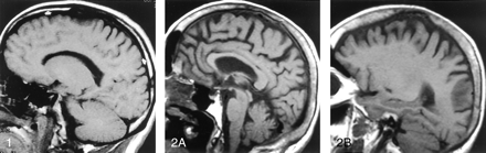 Fig 2.