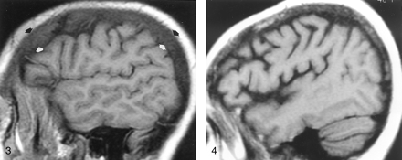 Fig 3.