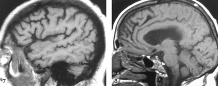 Fig 8.