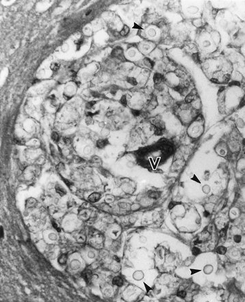 Fig 3.