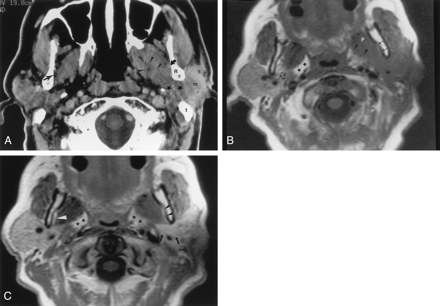 Fig 2.