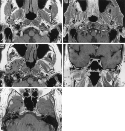 Fig 5.