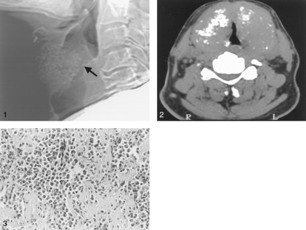 Fig 2.