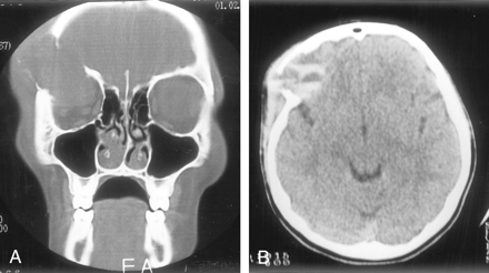 Fig 1.