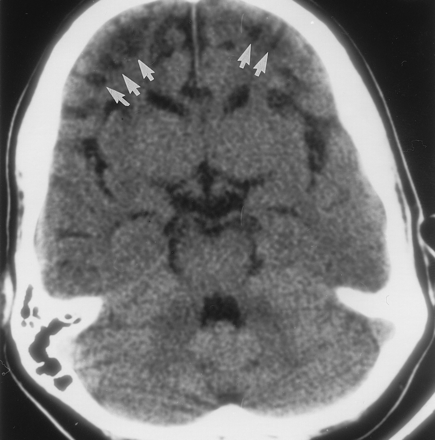 Fig 1.
