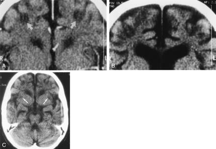 Fig 2.