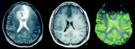 Fig 1.