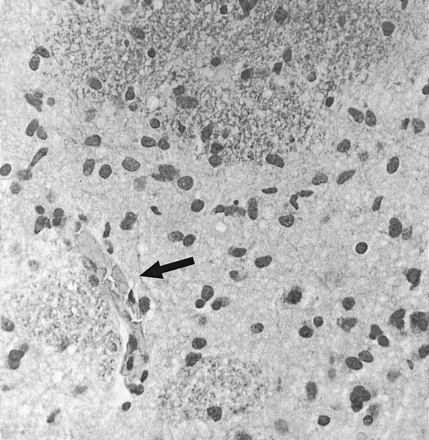 Fig 3.