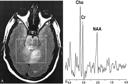 Fig 4.