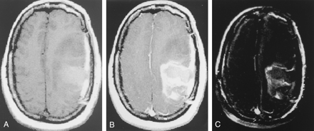 Fig 2.