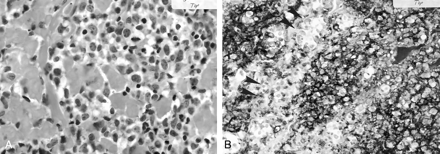 Fig 2.