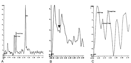 Fig 2.