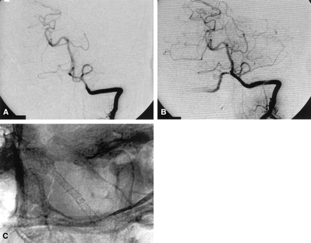 Fig 2.