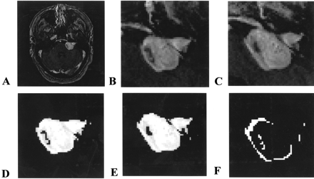 Fig 6.