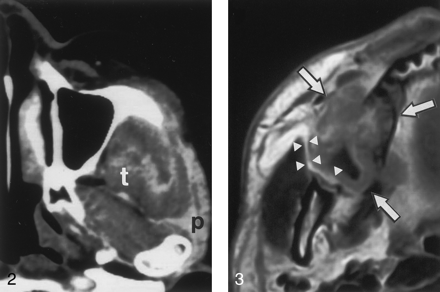 Fig 3.