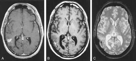 Fig 1.