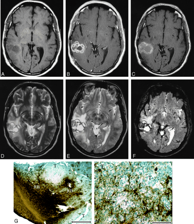 Fig 3.