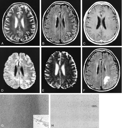 Fig 1.